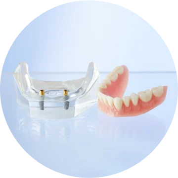 Aspen Dental implant supported dentures
