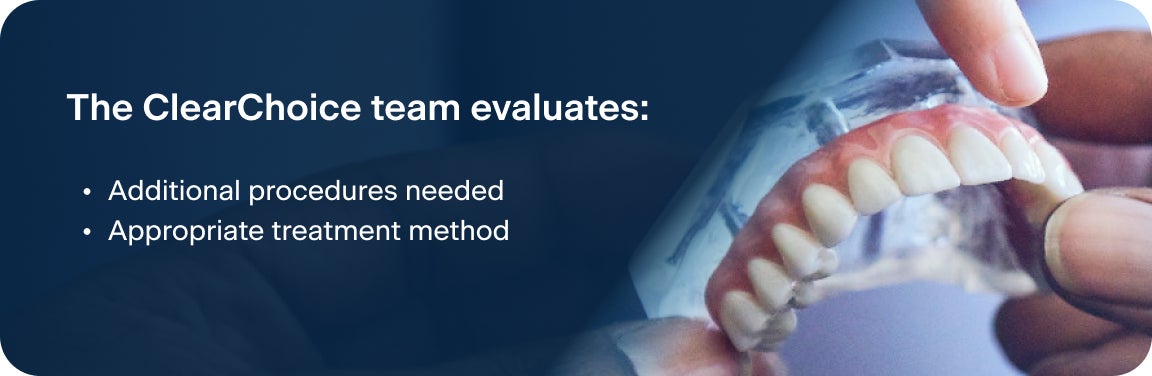 An image of an upper arch teeth model, with text explaining what the ClearChoice team evaluates during a consultation, including additional procedures needed, and the appropriate treatment method.