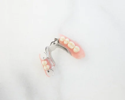 Aspen Dental Cast Partial Dentures. 