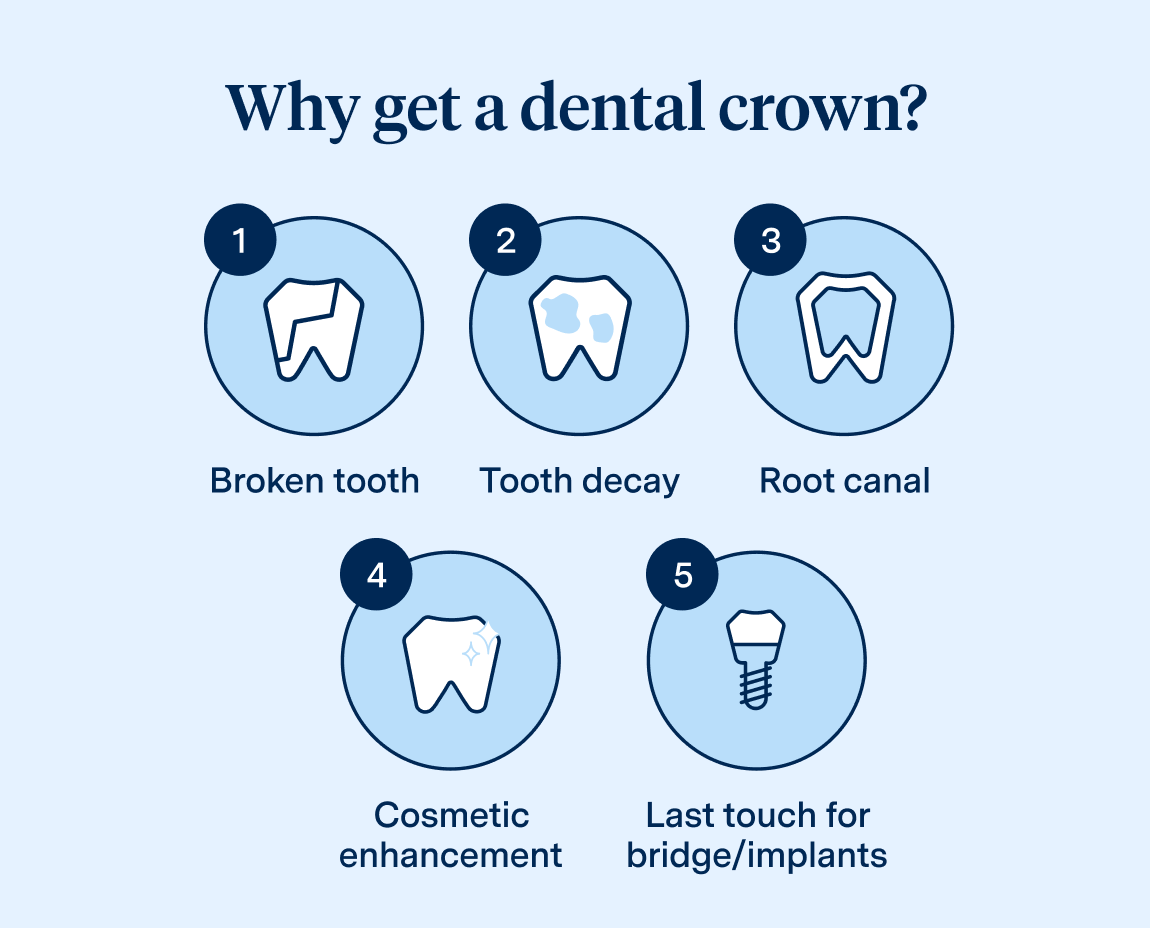 Illustration of teeth in circles highlighting various reasons for getting a dental crown: broken tooth, tooth decay, root canal, cosmetic enhancement, and completion for bridges/implants.