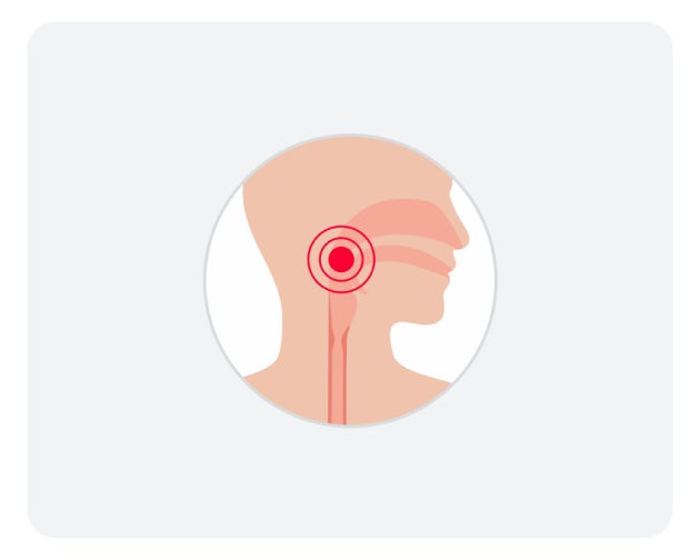 An illustration of a human silhouette facing towards the right. We can see the outline of the throat, with red circles surrounding it, signifying that there is an issue within the throat such as difficulty swallowing.