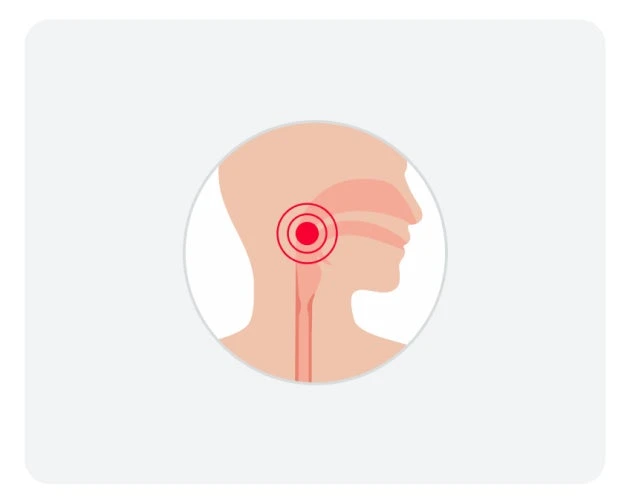 An illustration of a human silhouette facing towards the right. We can see the outline of the throat, with red circles surrounding it, signifying that there is an issue within the throat such as difficulty swallowing.