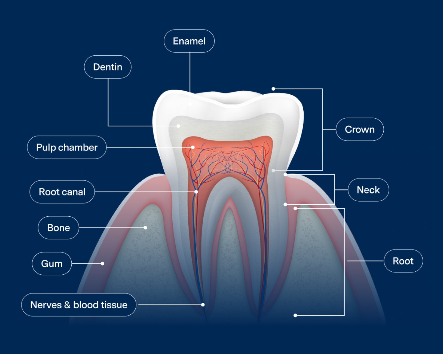 A cross-sectional diagram of a healthy tooth, showcasing the the tooth anatomy with each part labeled starting with the crown the enamel, dentin. The internal and external tooth root system link pulp chamber, root canal, bone, gum, nerves and blood tissue, against a blue background with the label "Healthy tooth" in the top left corner.