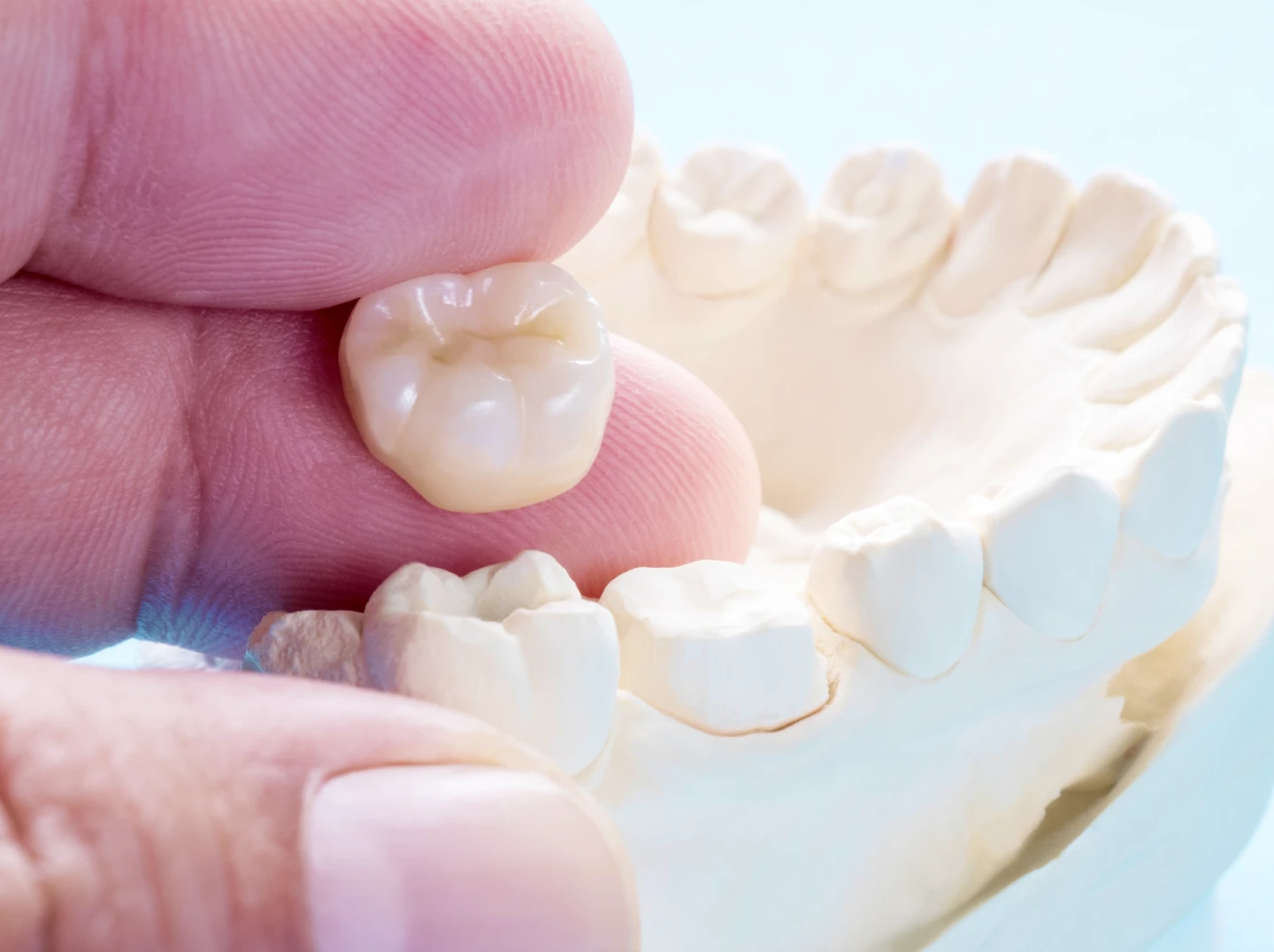 A hand holds a dental crown next to a model of bottom teeth. 
