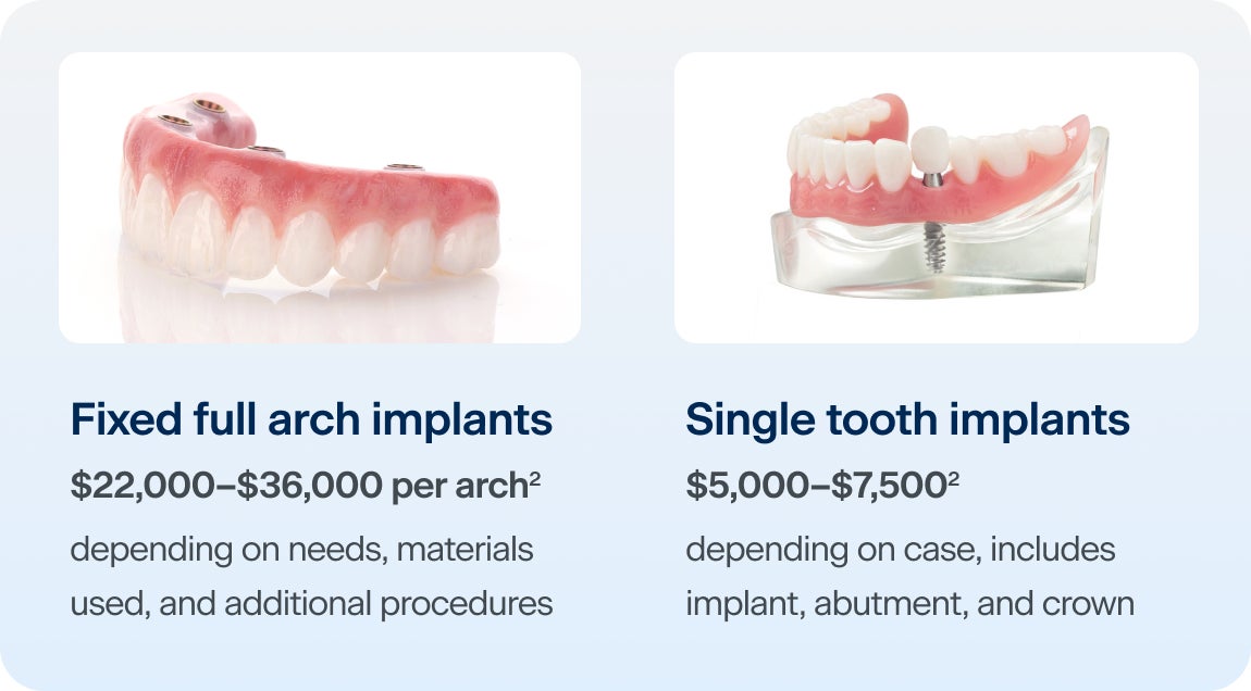 An image comparing the cost of fixed full arch implants versus single tooth implants. A fixed full arch implant may cost $23,000 to $31,000 per arch, depending on needs, materials used, and additional procedures. Whereas a single tooth implant may cost $5,000 to $7,500, depending on case, this cost includes the implant, the abutment, and the crown.