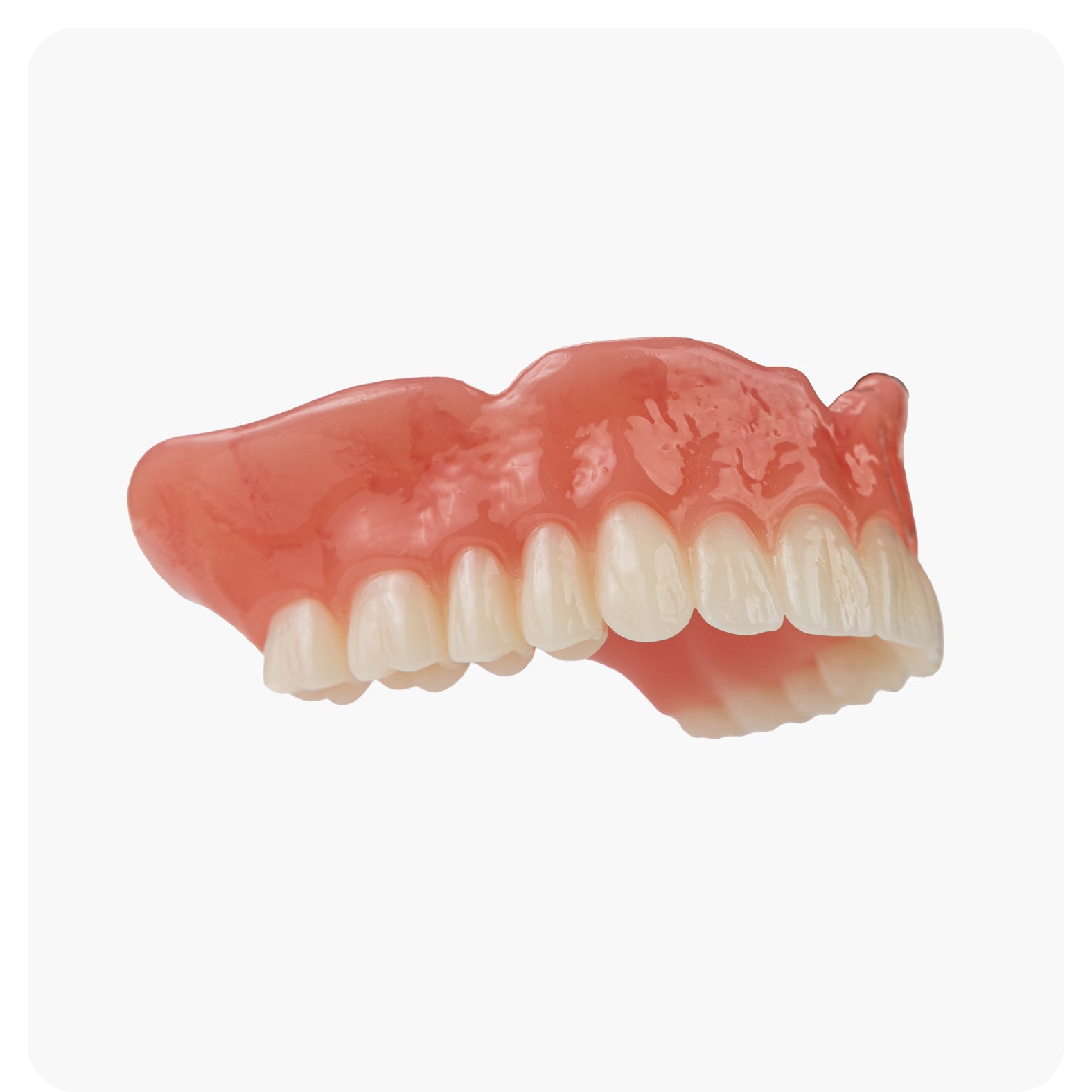 A side view of an upper denture model shown against a white background, illustrating detailed denture design and structure for Aspen Dental.
