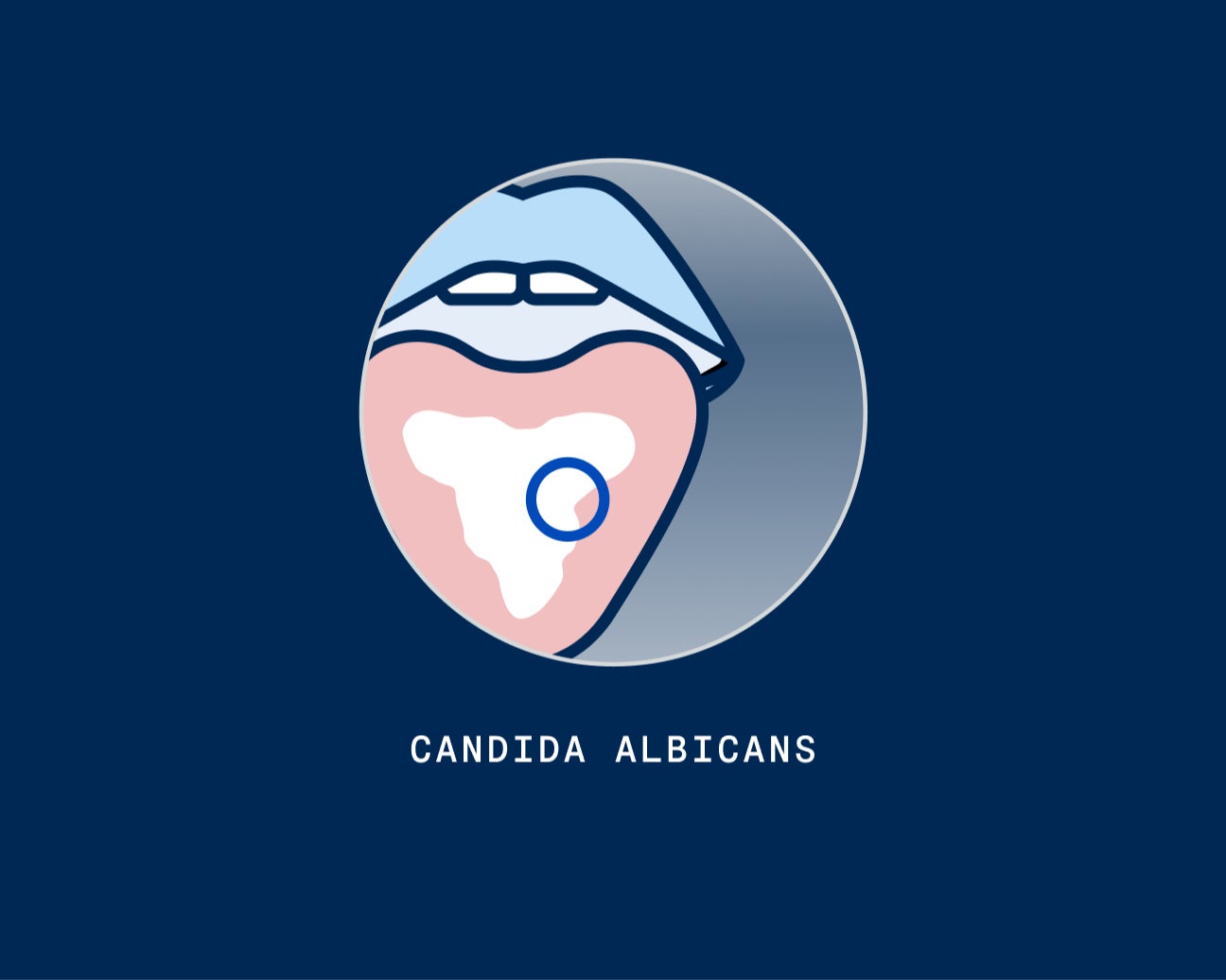 Illustration of a mouth with a tongue showing a white patch, representing Candida Albicans infection, beneath the text "CANDIDA ALBICANS