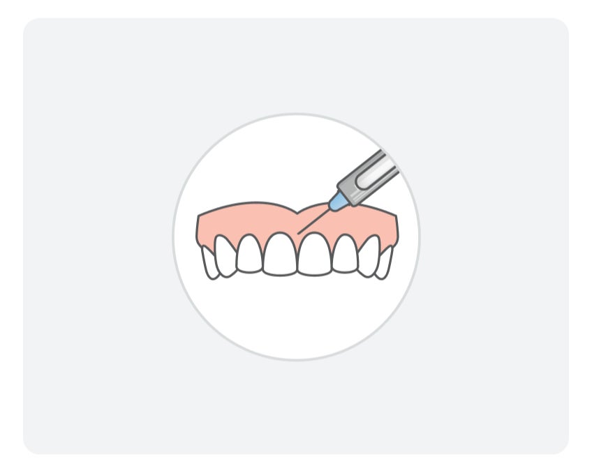 A graphic of a syringe being applied to the gums of a top row of teeth, indicating pain management treatment is to be used.