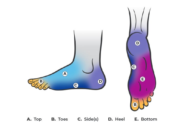 Foot Pain Causes And Treatment | WellNow Urgent Care