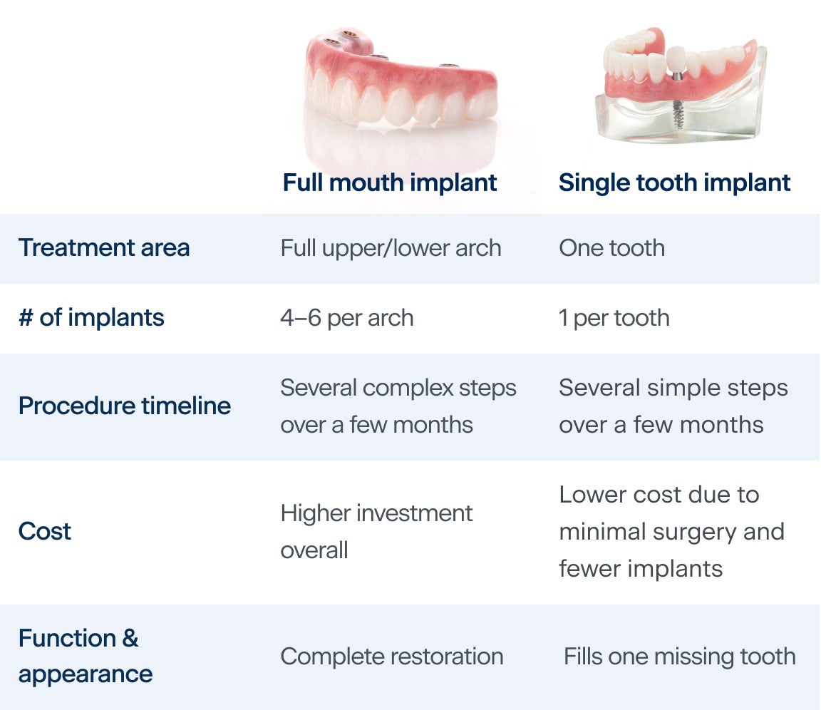 A chart comparing the differences between full mouth dental implants versus single tooth dental implants. Full mouth dental implants treat a full upper or lower arch, has 4 to 6 implants per arch, includes several complex steps over a few months, is a highest investment overall, and offers complete restoration, whereas single tooth dental implants treat one tooth, has 1 implant per tooth, includes several simple steps over a few months, has a lower cost due to minimal surgery and fewer implants, and each fills one missing tooth.