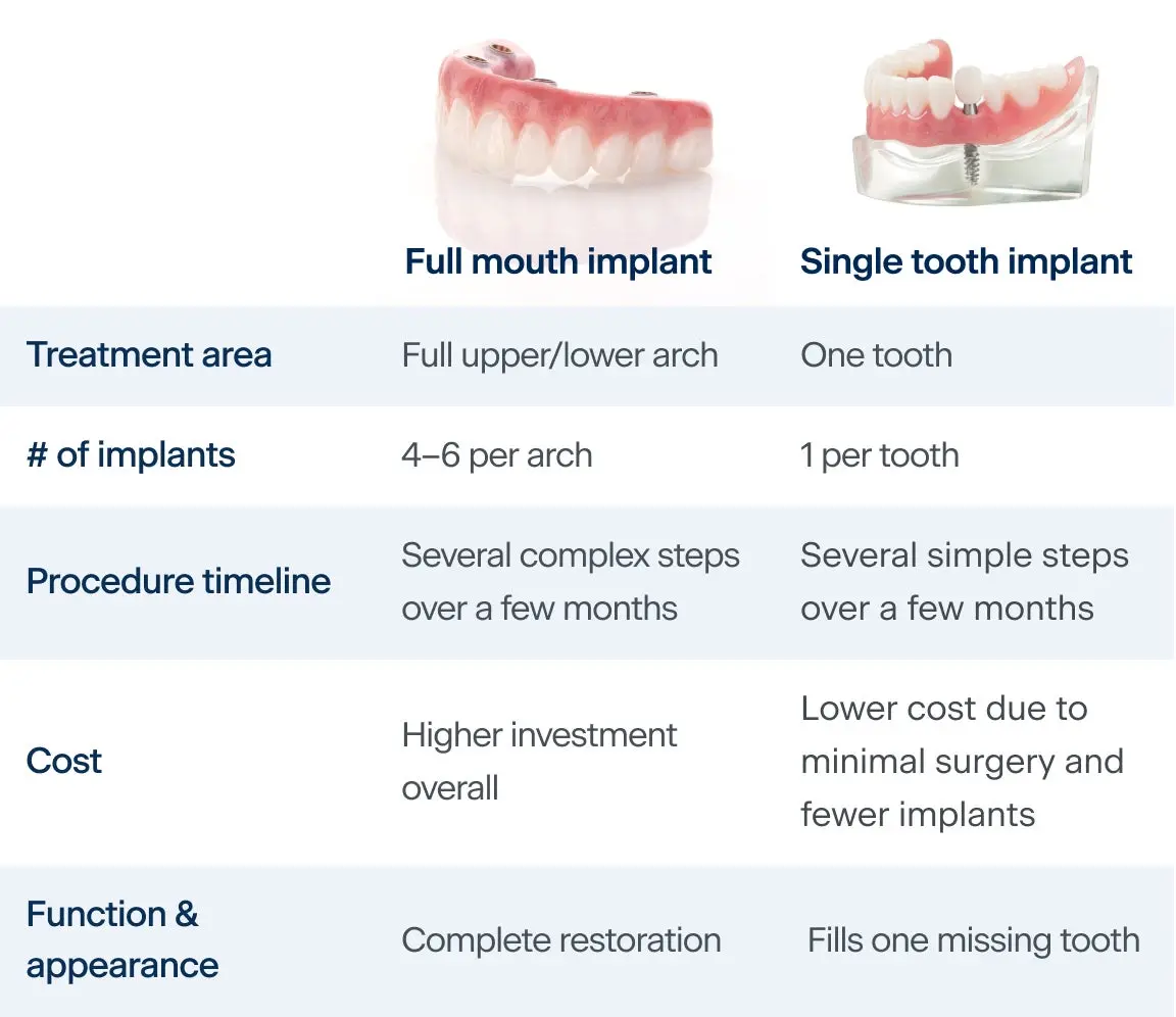 Full mouth dental implants or single tooth implants: What’s right for ...