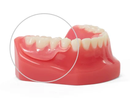 Flexilytes℠ partial dentures showcased on lower denture model, emphasizing tooth replacement on natural gums.