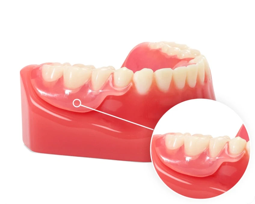 Partial Dentures Cost: Custom, Affordable Options | Aspen Dental