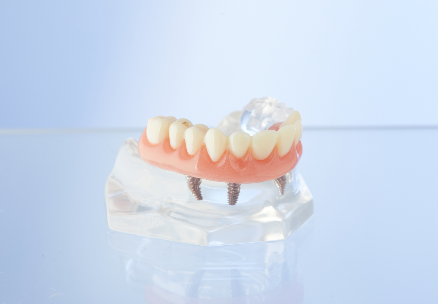 Cost of Dentures Without Insurance