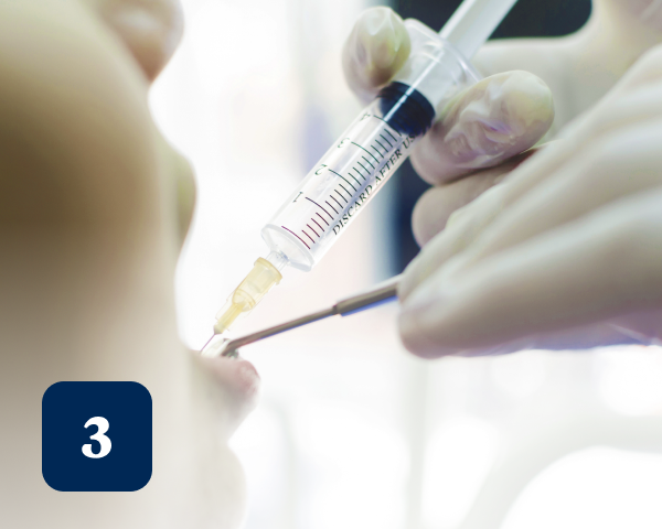 A close-up of gloved hands administering local anesthesia with a syringe into a patient's gums. A small blue box with the number 3 is visible in the bottom left corner.
