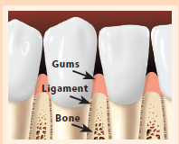 Aspen Dental healthy gums image