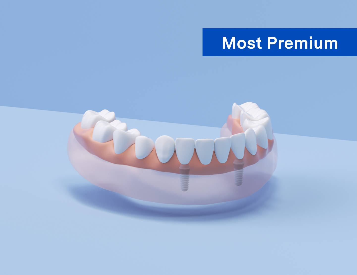 Dentures Costs and Offers Aspen Dental