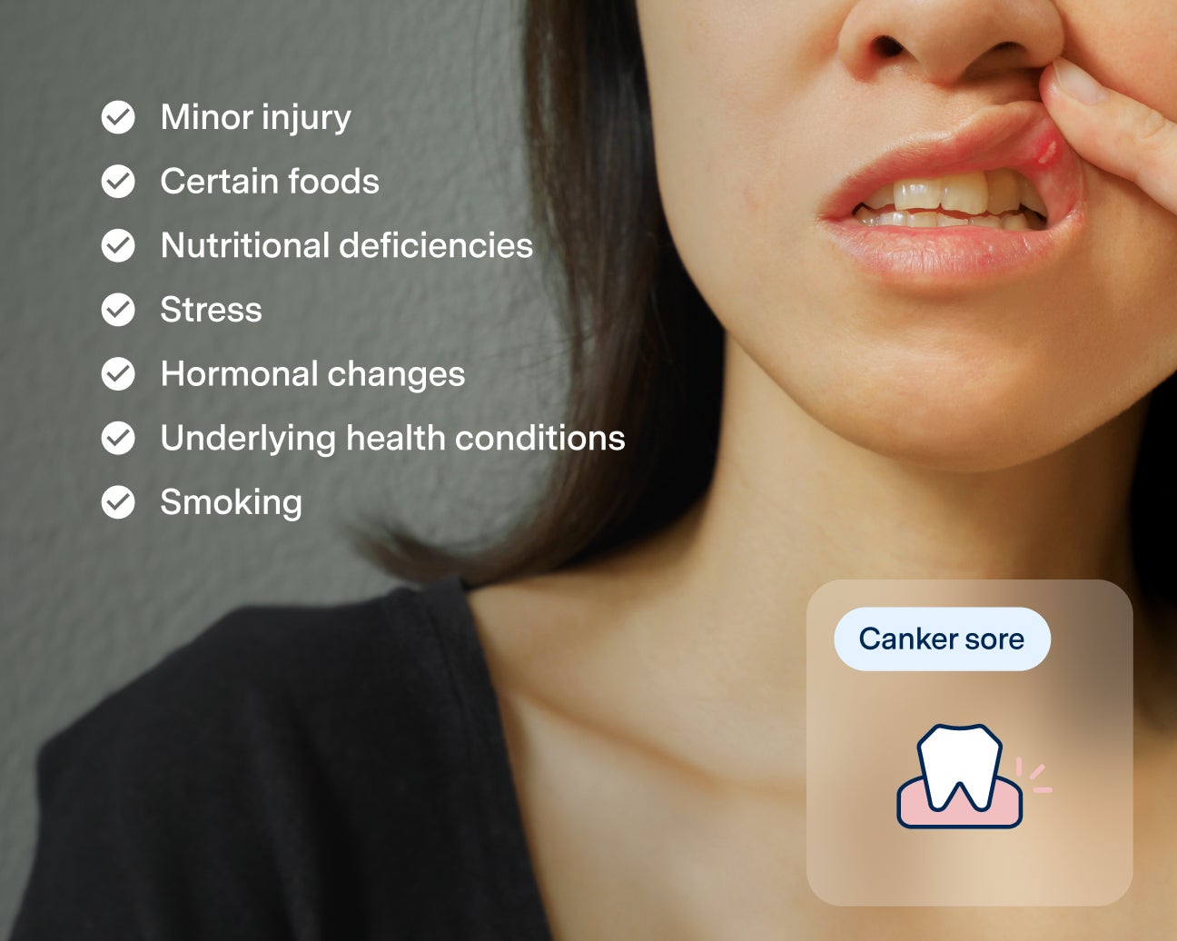 Close-up of a person with a canker sore inside their mouth. A list on the side identifies potential causes: minor injury, certain foods, nutritional deficiencies, stress, hormonal changes, underlying health conditions, and smoking.