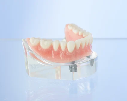 Aspen Dental Securefit Comfilytes Dentures.