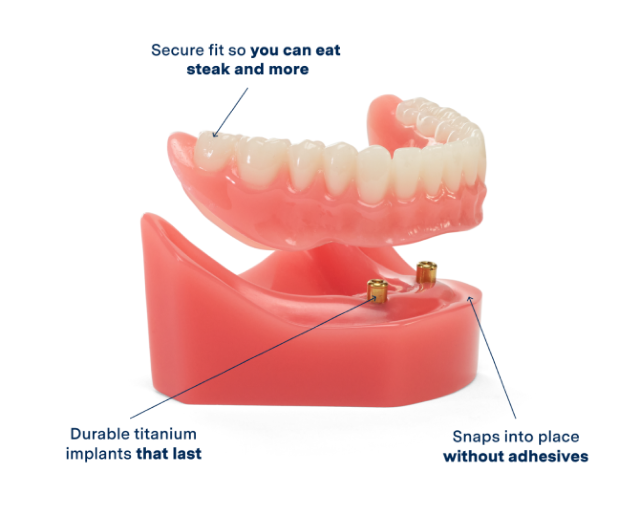 Replacement Dentures Services Find New Dentures at Aspen Dental