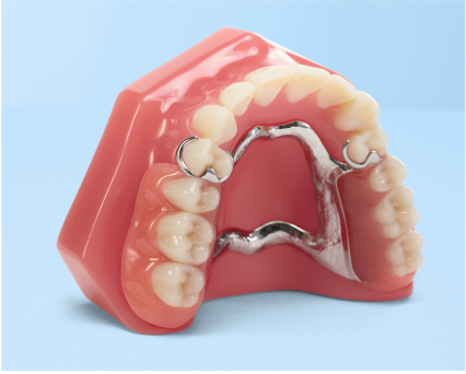 Aspen Dental Flexilytes dentures. 