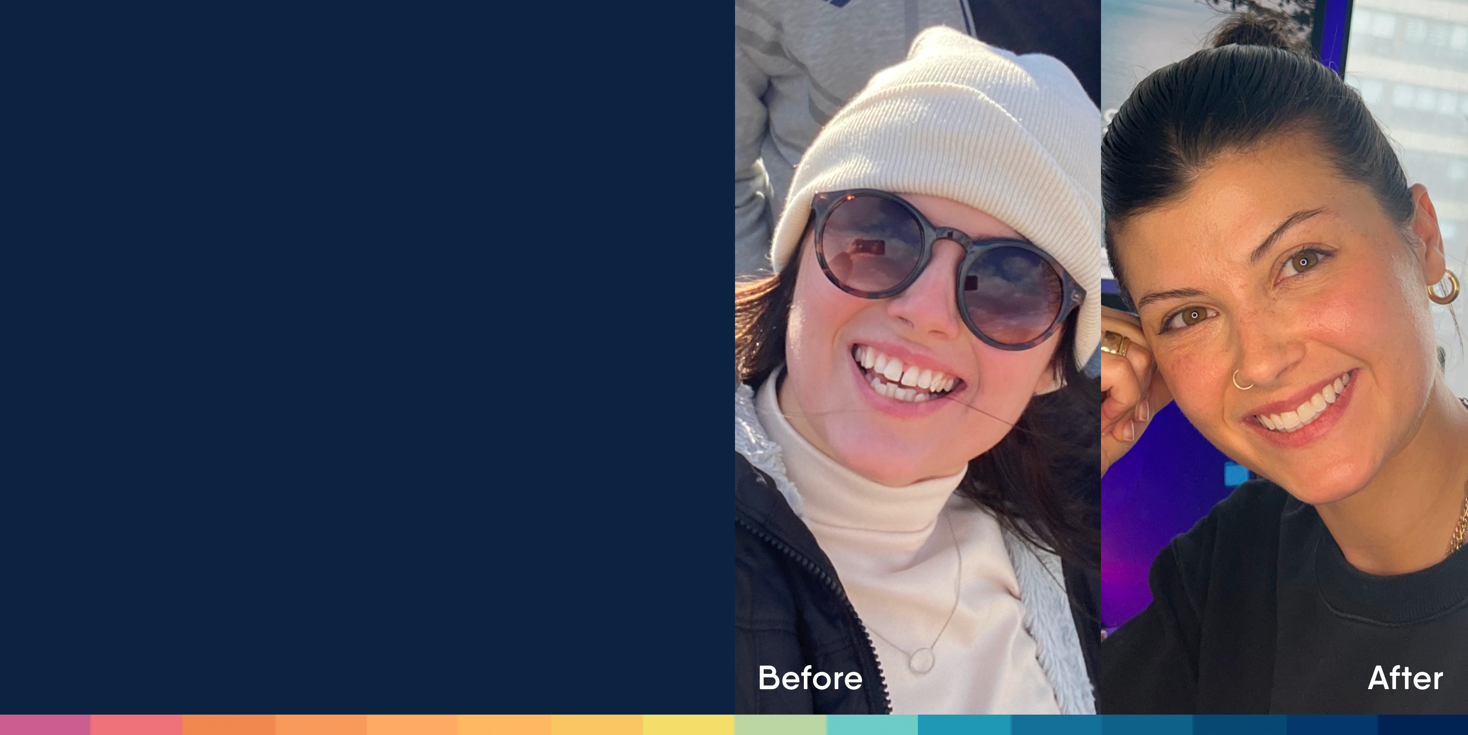 Before and After Motto Clear Aligners Reviews Aspen Dental