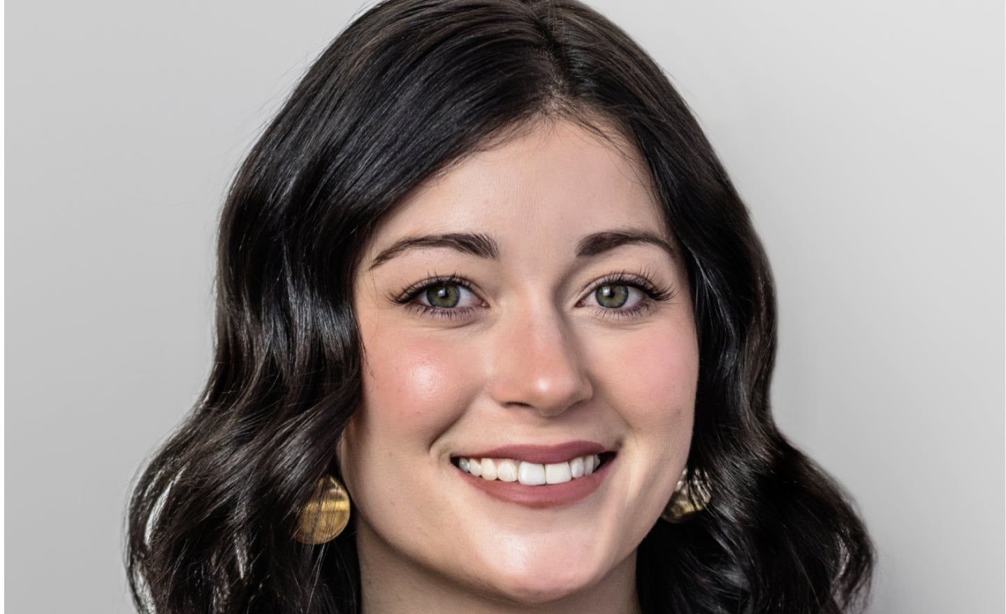 Chapter managing clinical director in Tonawanda, Kasey Weaver, is ready to create a personalized treatment plan to meet your aesthetic goals.