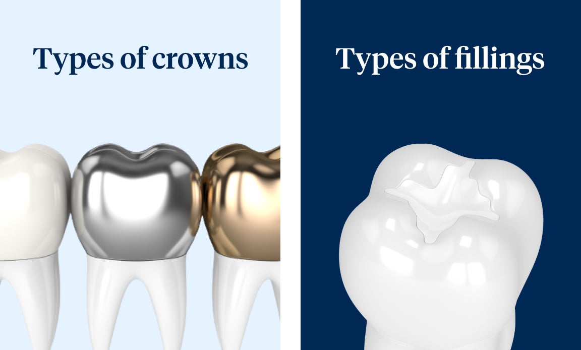 Illustration showing different types of dental crowns and fillings, including metal, ceramic, and gold options, under the heading “Types of crowns,” demonstrating the variety of materials used for dental restorations.