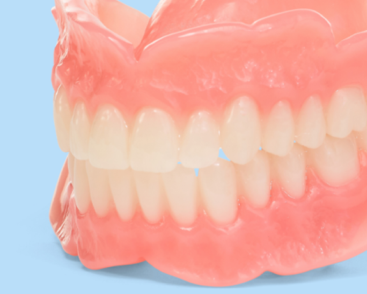 Aspen Dental full dentures. 