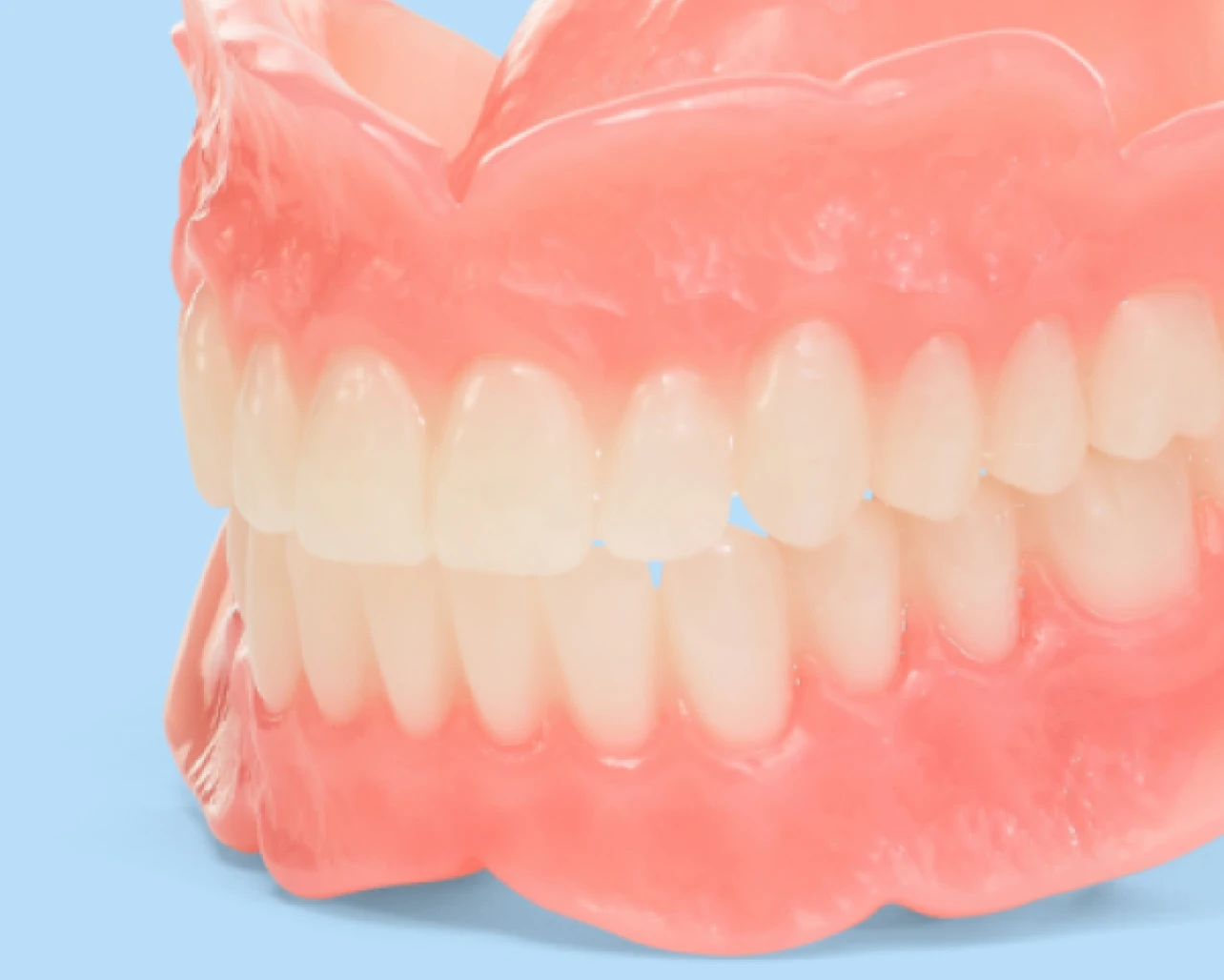 Aspen Dental full dentures.