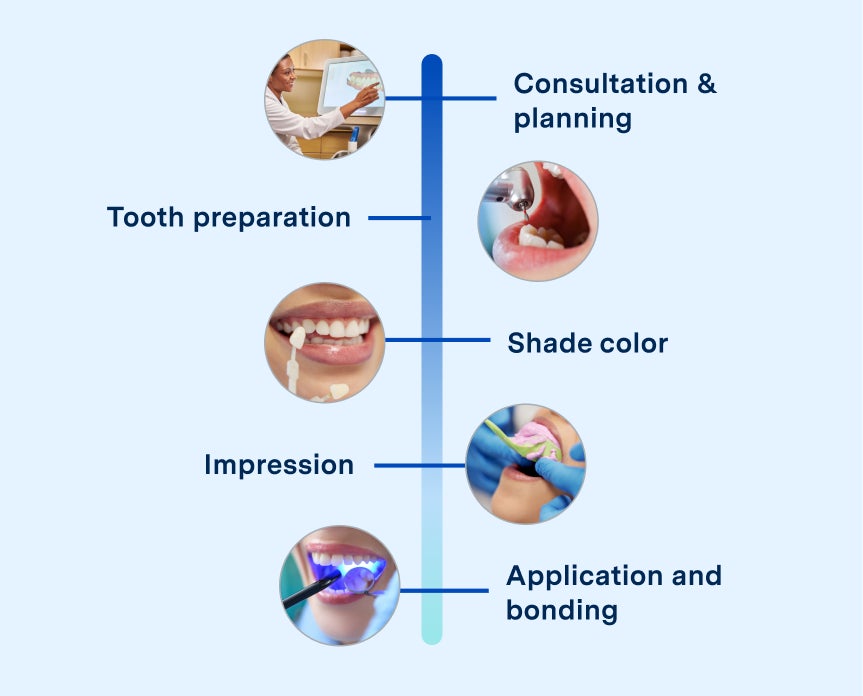 A happy dental patient smiling during a dental veneers procedure at Aspen Dental, highlighting a comfortable and professional dental care experience.