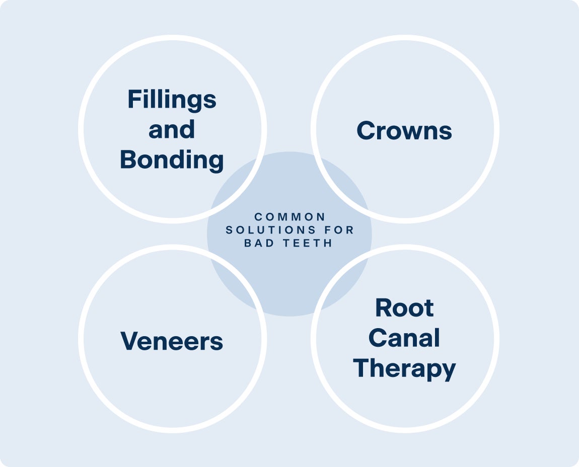 Infographic by Aspen Dental highlighting common solutions for bad teeth, including fillings and bonding, crowns, veneers, and root canal therapy, arranged in a circular layout with a central label.