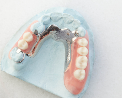 Aspen Dental Flexilytes© Combo Dentures