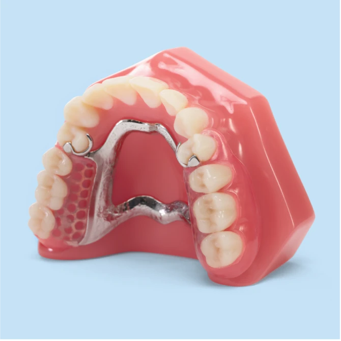 Aspen Dental Partial Dentures. 