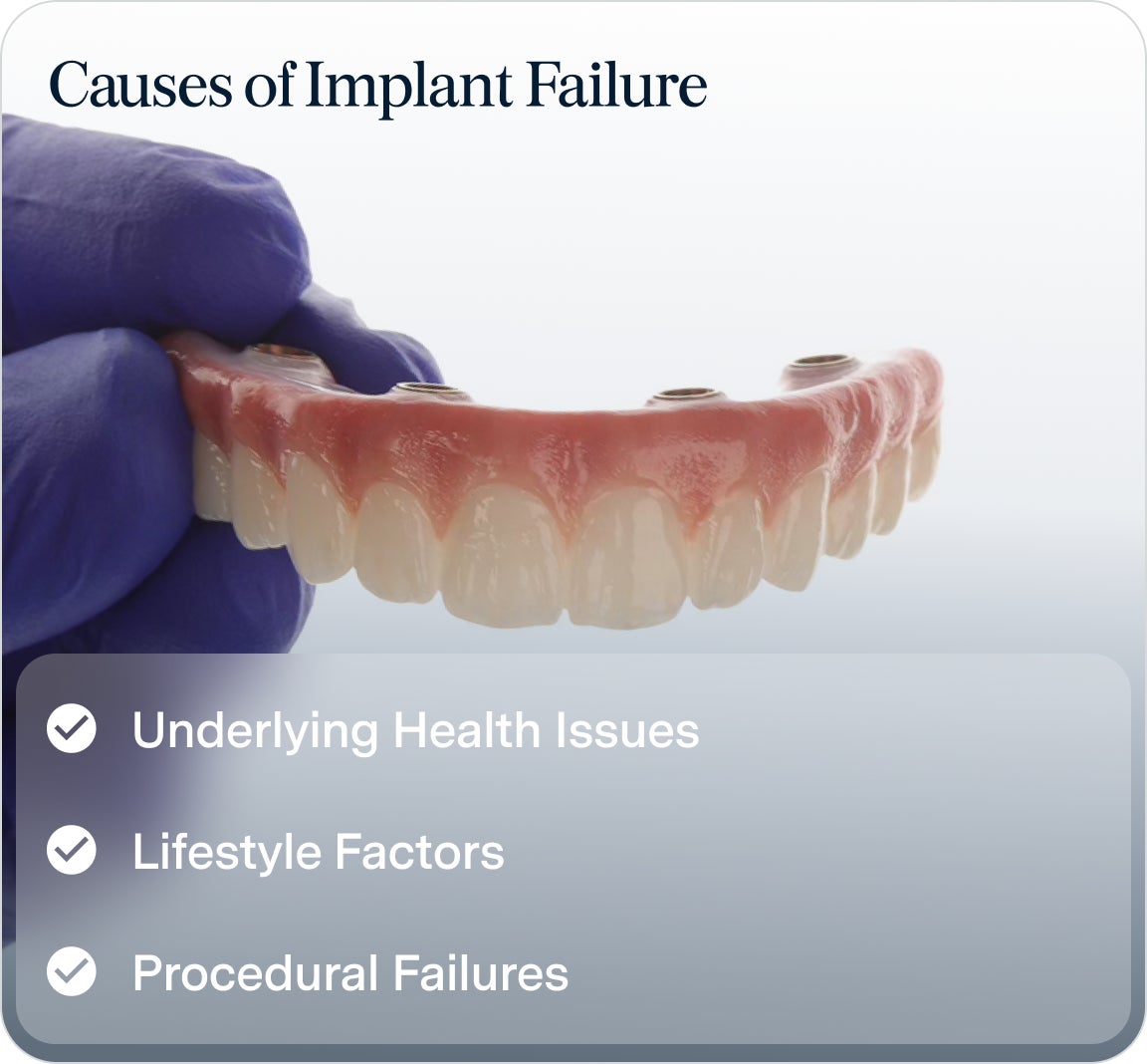 An image of an upper arch implant model, with text illustrating the potential causes for dental implant failure: underlying health issues, lifestyle factors, and procedural failures.