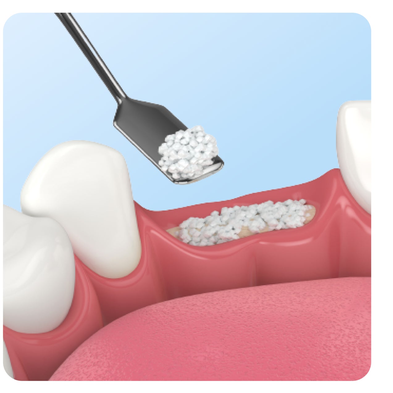 Oral Surgery in Hutchinson, KS Aspen Dental