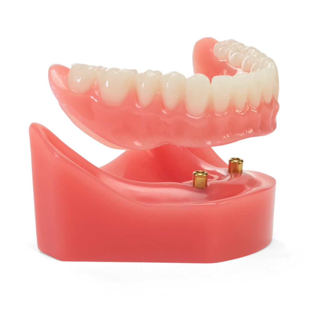 A graphic displaying a full lower implant dentures arch with a white background.