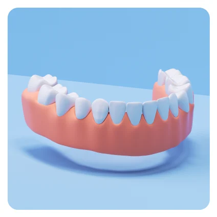 Aspen Dental custom dentures. 