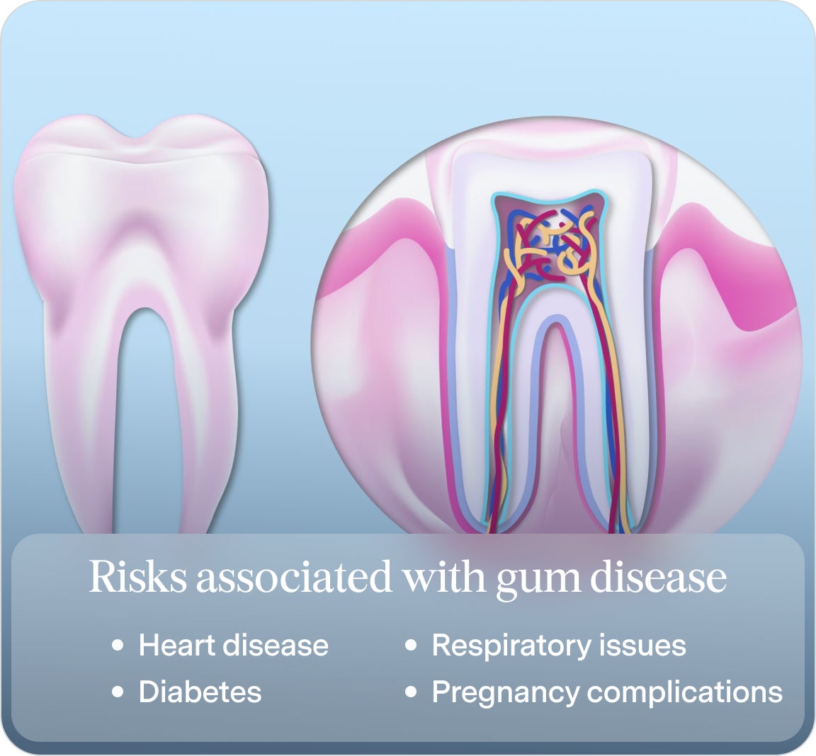 An image of the roots of a tooth, with text on some of the risks associated with gum disease, including heart disease, diabetes, respiratory issues, and pregnancy complications.