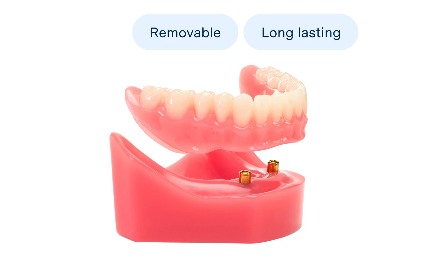 On a white background, a model of implant dentures is shown with the words 'removable' and 'long-lasting' emphasizing it as a durable solution.