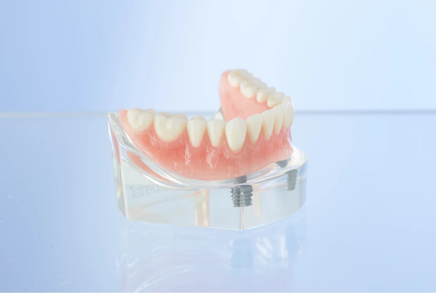 Aspen Dental snap in dentures. 