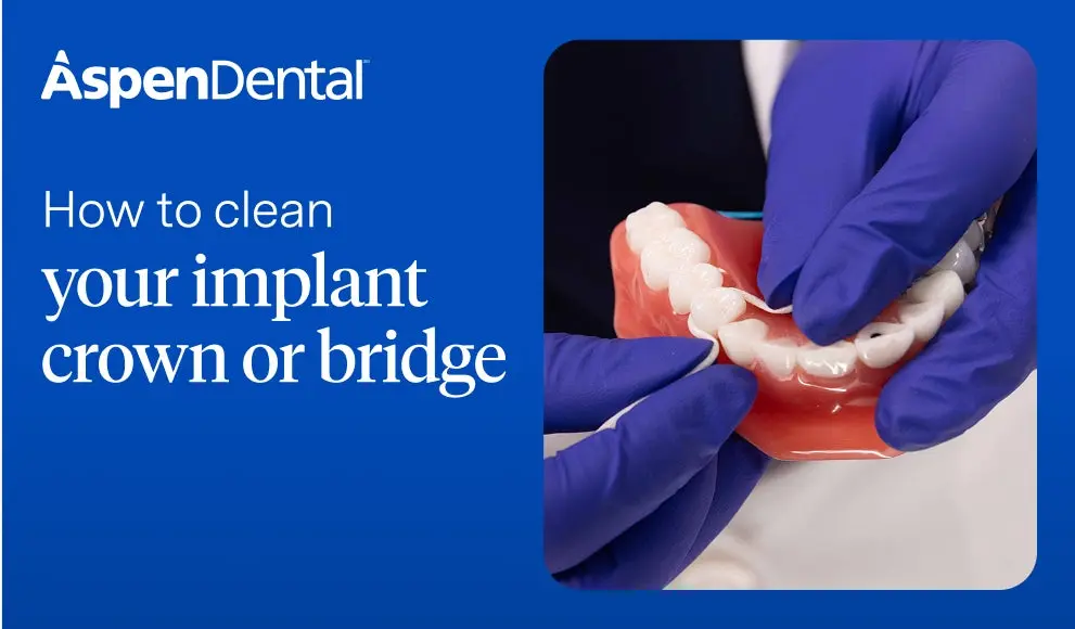 Aspen Dental provider explaining how to clean a dental implant crown or bridge – oral hygiene guide.
