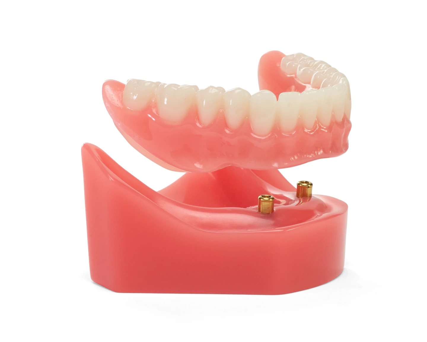 A set of lower dentures with implants on a red gum model.