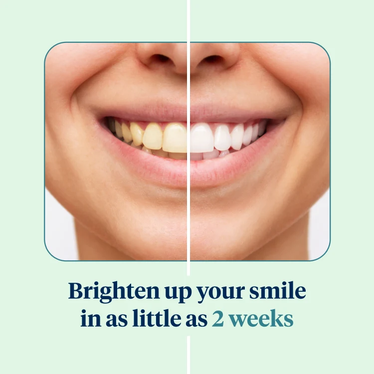 Teeth Whitening London