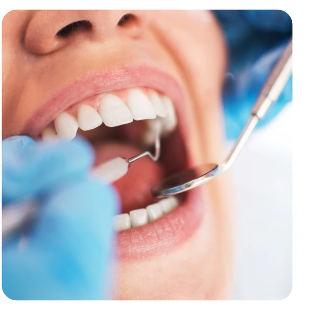 A dentist performing a dental procedure on a woman with white teeth, using a pick and small mirror tool.