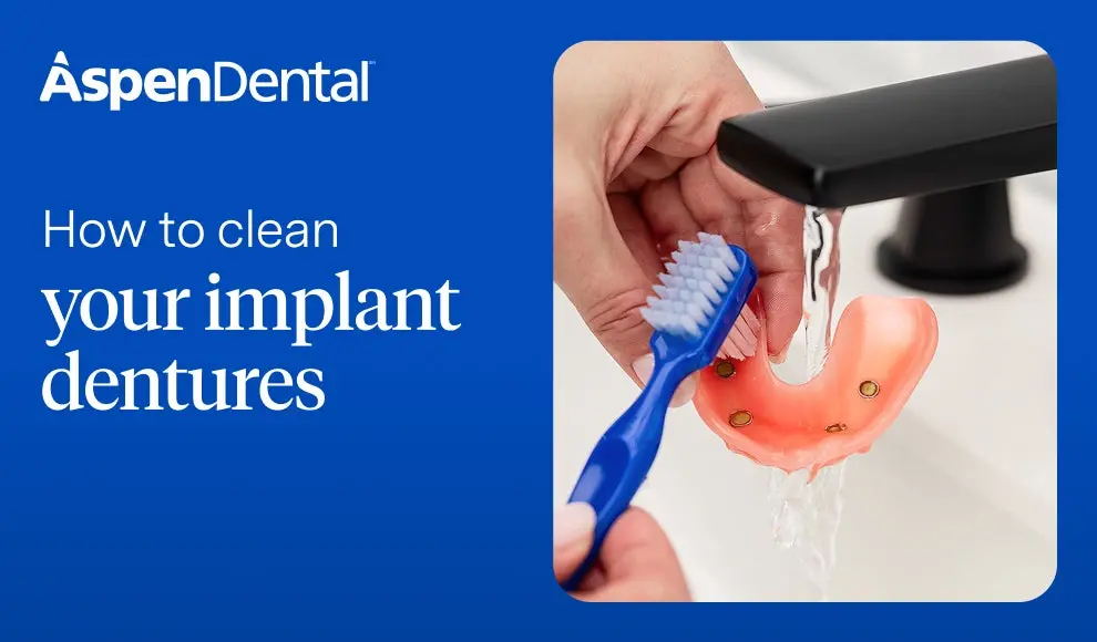 Aspen Dental provider explaining how to clean your implant dentures – expert oral hygiene guidance.