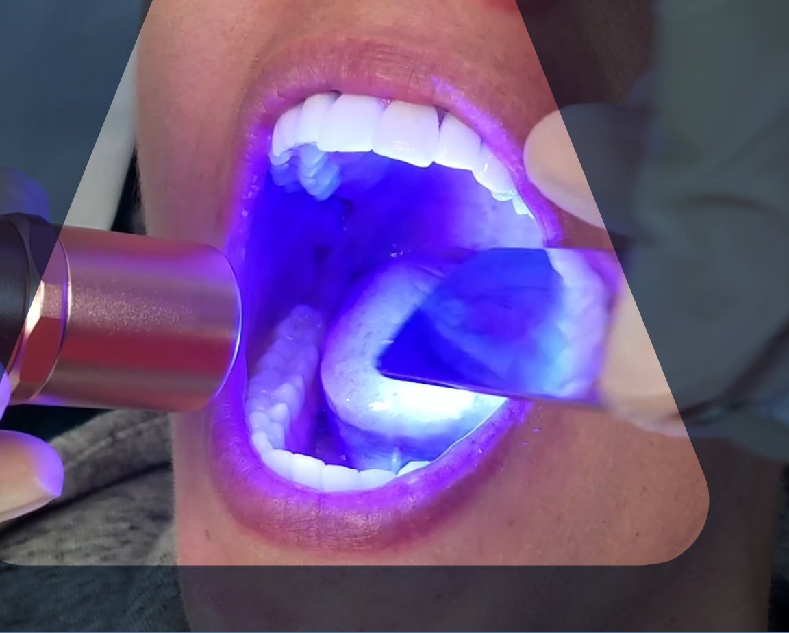 Fluorescence technology mouth and oropharyngeal cancer screening on patient.