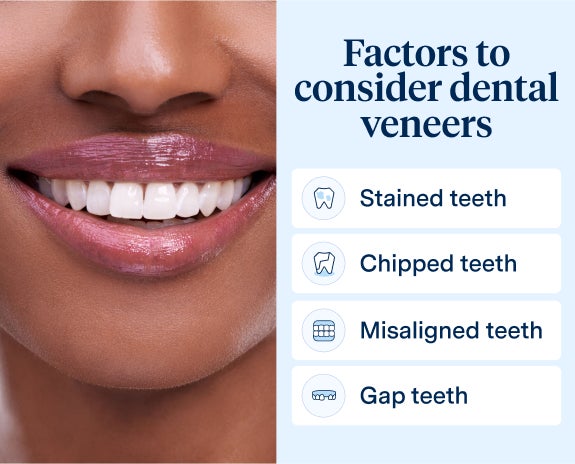 An infographic from Aspen Dental highlighting factors for considering dental veneers, including stained teeth, chipped teeth, misaligned teeth, and gap teeth, alongside a close-up of a woman’s bright smile.