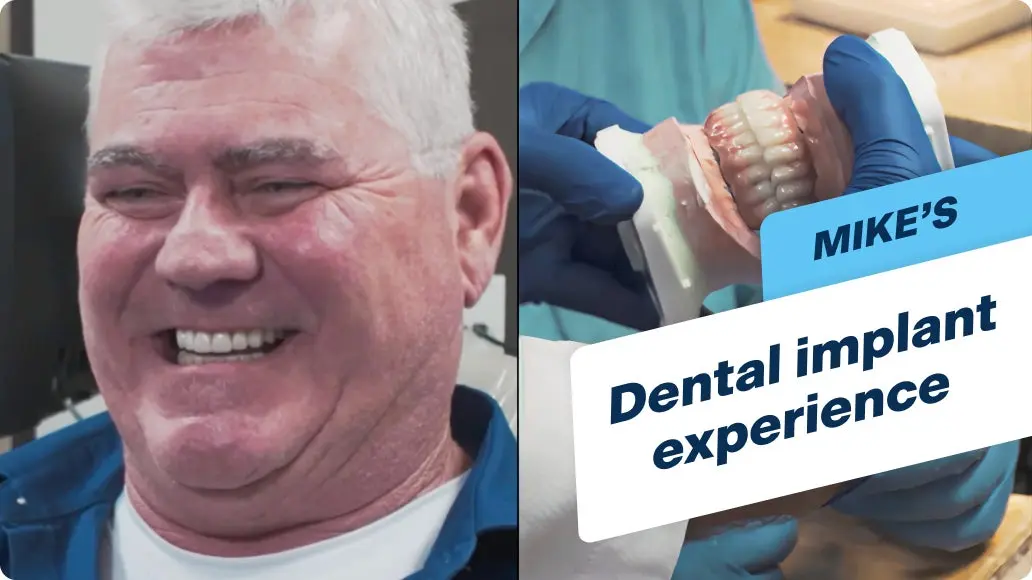 An image of Mike, a patient at ClearChoice Dental Implants Center, smiling with his new dental implants on the left, with an image of a prosthodontist holding a full arch teeth model on the right, along with a banner that says "Mike's dental implant experience".