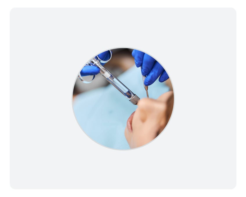 A dental procedure in progress, with a top view of a patient’s face. A dentist wearing blue gloves uses a syringe and dental tool to apply local anesthesia.